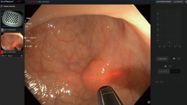 ラインジェネレーター